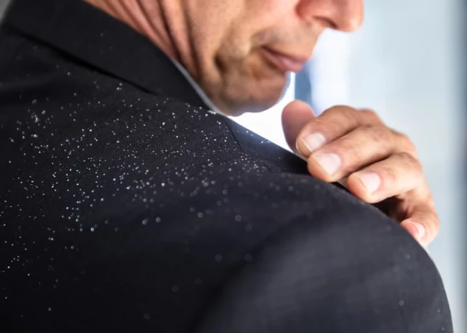 Blaugznas var būt sākums kam nopietnākam – vai tu zini, kas tās izraisa?