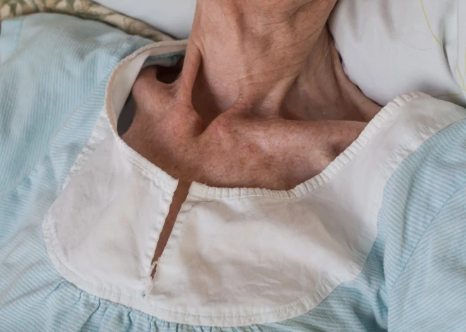 Государство ищет деньги на социальный уход - могут ввести социальное страхование для всех трудоспособных латвийцев