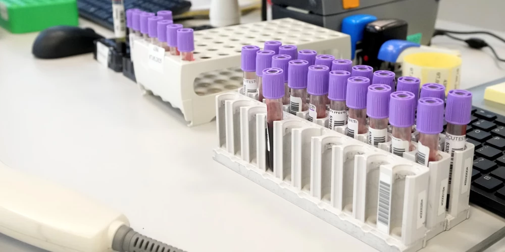 Infektologu asociācija mudina ikvienu iedzīvotāju veikt C hepatīta testu.