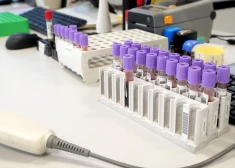 Latvija viena no līderēm C hepatīta izplatībā Eiropā – ārsti aicina pārbaudīties