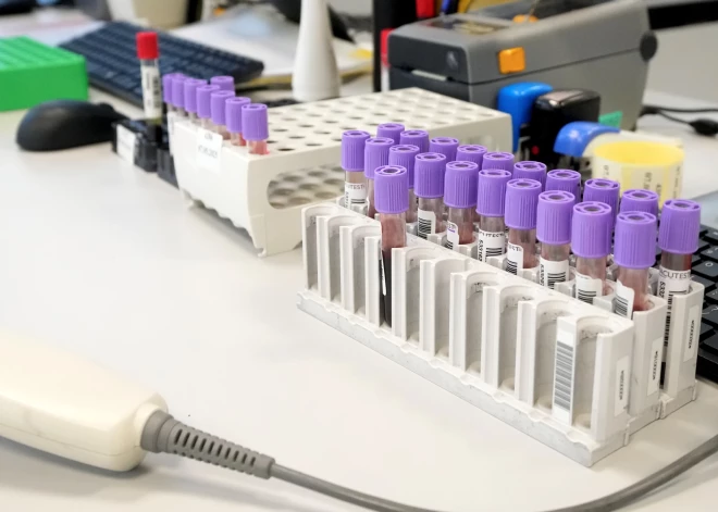 Latvija viena no līderēm C hepatīta izplatībā Eiropā – ārsti aicina pārbaudīties