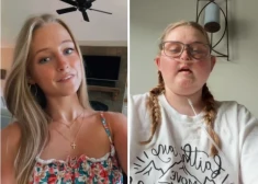 Чуда все же не произошло: от опухоли мозга умерла 19-летняя звезда TikTok