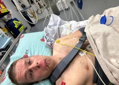 Nopietnas traumas dēļ Jonasam ies secen MXGP posms Ķegumā