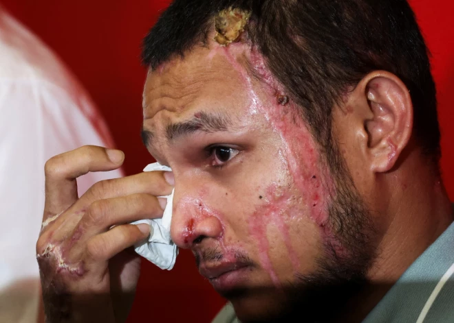 Fiziskas un emocionālas rētas, kas mainīja futbolista dzīvi — brauciens uz lielveikalu kļuva par traģēdiju