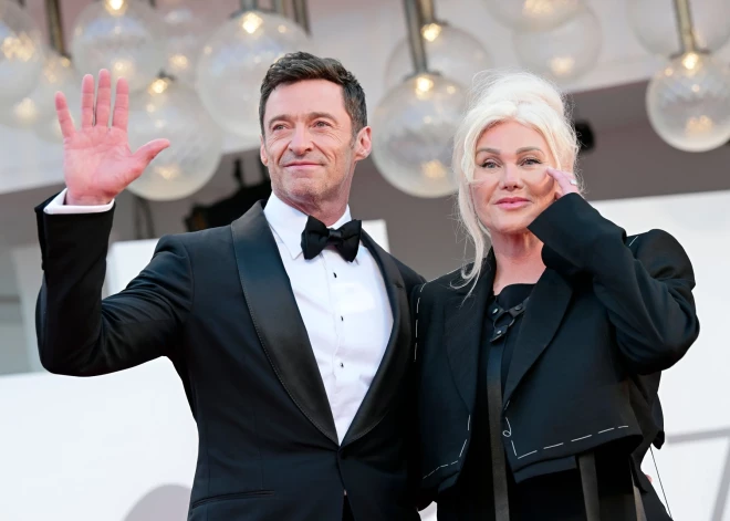 Hjū Džekmena šķirtā sieva gatavojas izdot grāmatu un atklāt visu