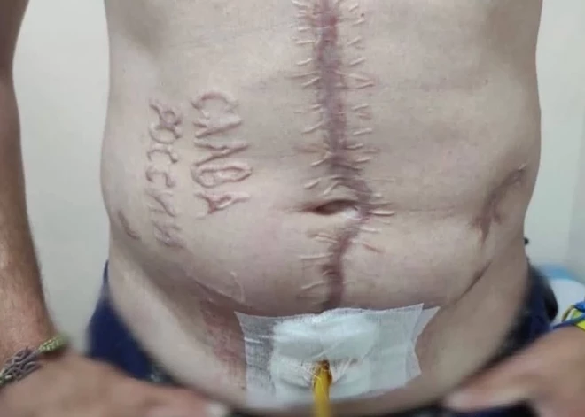 Krievi uz Ukrainas karagūstekņa ķermeņa iededzinājuši vārdus “Slava Krievijai”. FOTO