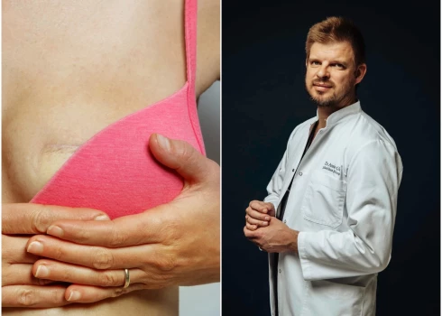 Nevienai sievietei nav jādzīvo bez krūtīm, saka plastikas ķirurgs Ansis Ģīlis. Foto: Shutterstock, publicitātes foto