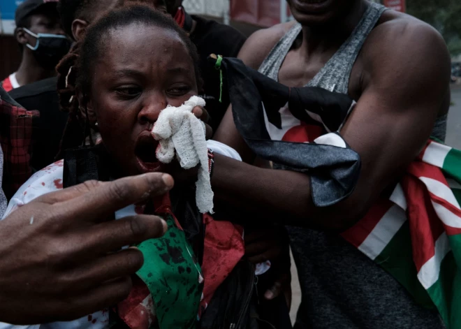 Kenijā: protestu laikā ievainoti vairāk nekā 400 cilvēki, astoņi nogalināti