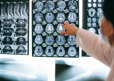 Lielākajai daļai Ziemeļeiropas valsts iedzīvotāju diagnosticē psihiskus traucējumus