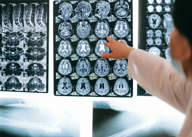 Lielākajai daļai Ziemeļeiropas valsts iedzīvotāju diagnosticē psihiskus traucējumus