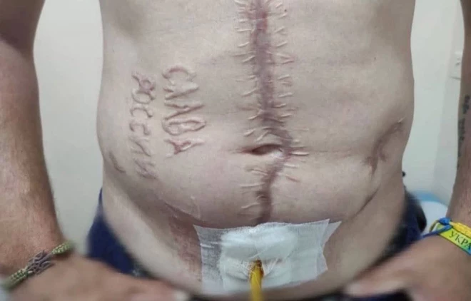 Ukraiņu ārsts redzēja šo uzrakstu un nevarēja to izturēt - viņš nofotografēja viņu un ievietoja attēlu tiešsaistē. 