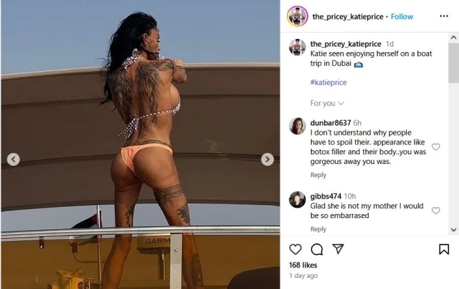 Keitija parāda, kā viņas sēžamvieta izskatā spēc jaunākās operācijas.