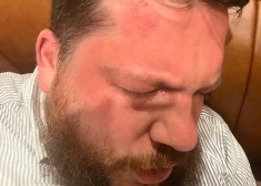 Polijas prokuratūra noskaidrojusi, kas stāv aiz uzbrukuma Krievijas opozicionāram Volkovam
