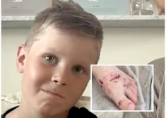 Līdaka Zviedrijā uzbrukusi 8 gadus vecam zēnam. "Vairākas brūces bija ļoti dziļas!"