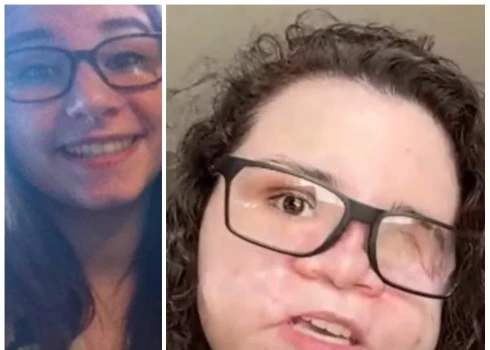 Amedija Djūjija pusaudzes gados un tagad (ekrānuzņēmumi no "Facebook" un video; kolāža: jauns.lv)