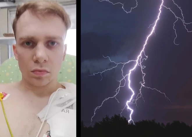 Молния ударила в шею и прошла сквозь все тело: латвиец поделился в TikTok историей выживания