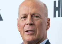 Brūss Viliss vairs gandrīz nespēj runāt un lasīt, apgalvo avoti