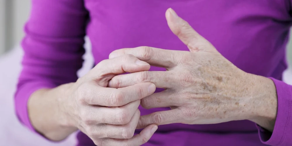 Osteoartrīts ir locītavu slimība. Parasti deformāciju novēro ceļgalos, pirkstos. Piemēram, tā dēvētie, mezglainie pirksti senioriem ir osteoartrīta sekas.