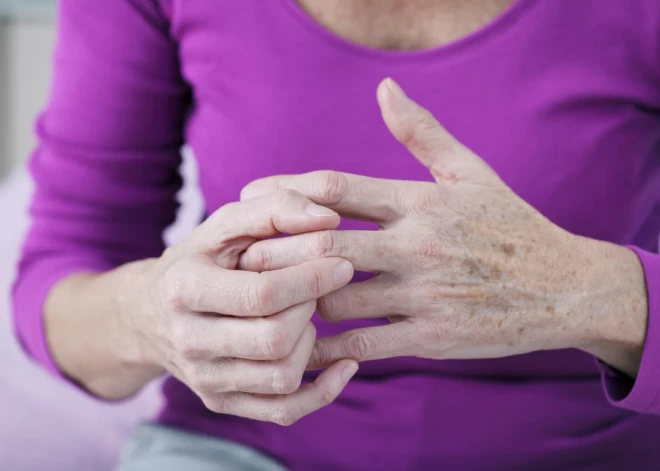 Sievietēm risks ir lielāks – kāpēc osteoartrīts tevi var pārsteigt nesagatavotu