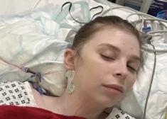 25-летняя Шарлотта страдала от вздутия живота, но выяснилось - она медленно умирает