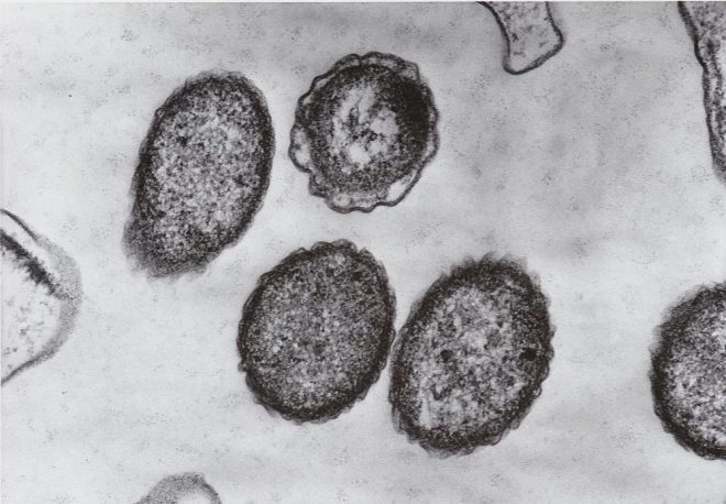 Vibrio vulnificus под микроскопом.