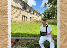 Максим Галкин устроил фотосессию в Даугавпилсе - гипс пока еще на месте