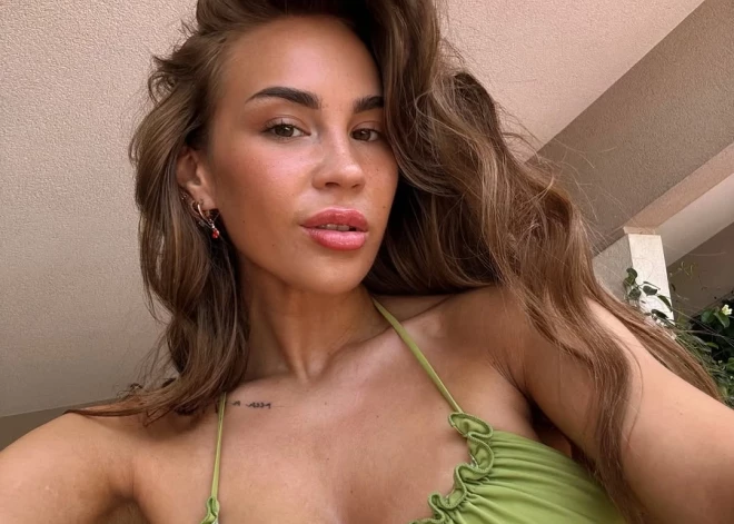 "Es zinu, kur ir robeža!” Lāsma Novika atklāti par savām skaistuma operācijām