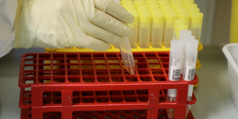 Ilustratīvs attēls.