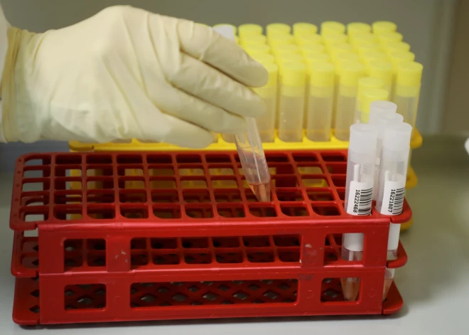 Skaidro ārsts: kādas slēptas veselības problēmas atklāj asins analīze