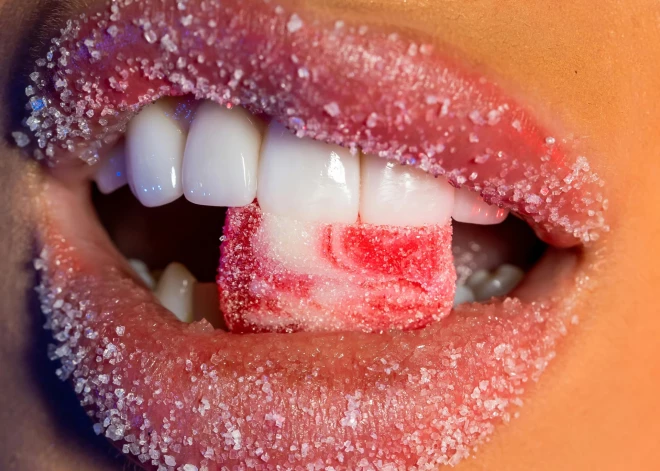 Kā saprast, ka ēdat pārāk daudz saldumu: dietologi nosauc 7 negaidītus simptomus