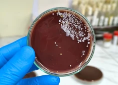 Пациенты в больницах по всей Европе в опасности: распространяется серьезная инфекция