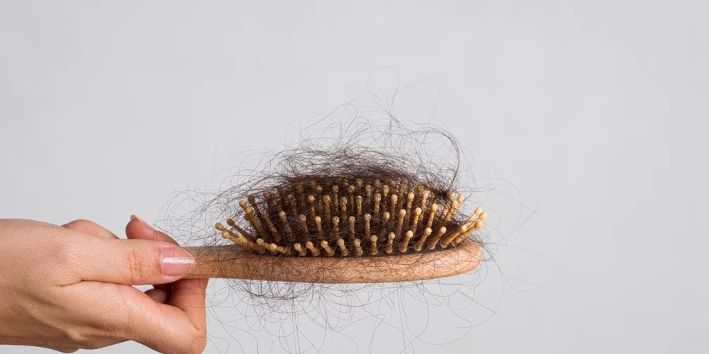 Выпадение волос может быть связано с вашим рационом, а не с возрастом.