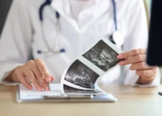 В Латвии предлагают ввести обязательные консультации перед абортом, чтобы защитить "нерожденную жизнь"