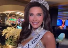 Skaistumkonkursa dalībniece atlases kārtā noņem parūku un drosmīgi atklāj cīņu ar alopēciju