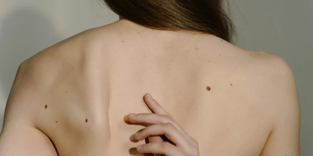 Ilustratīvs attēls.