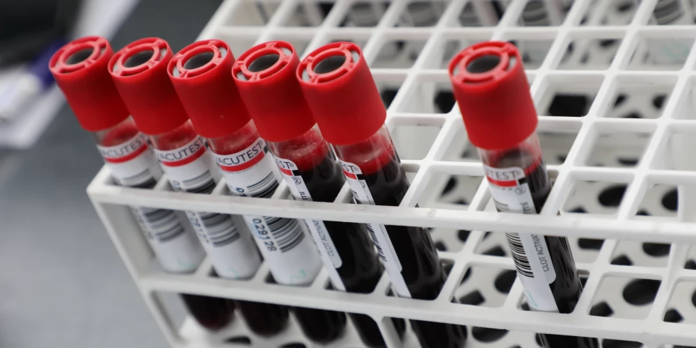 Ilustratīvs attēls.