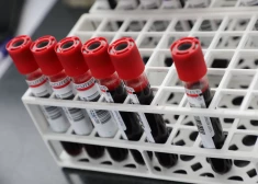 Eiropas Komisija līdz 2028. gadam plāno izveidot 100 sertificētus vēža centrus visā Eiropā