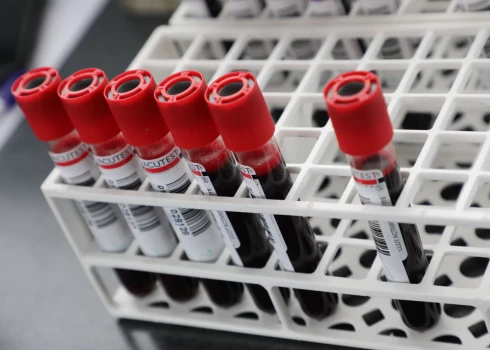 Ilustratīvs attēls.