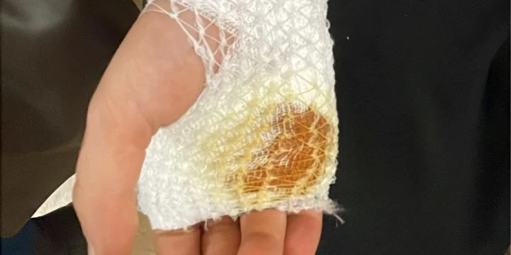 Meklē lieciniekus incidentam pie Rīgas Imantas vidusskolas – bērns ievainots ar nazi. 