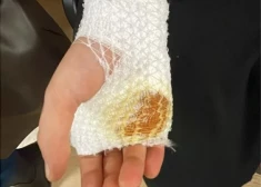 Разыскиваются очевидцы инцидента в Иманте - ребенок был ранен ножом