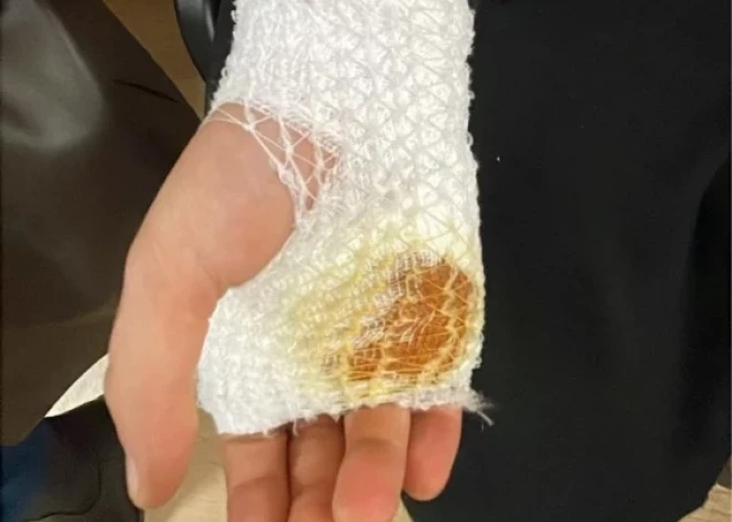 Разыскиваются очевидцы инцидента в Иманте - ребенок был ранен ножом