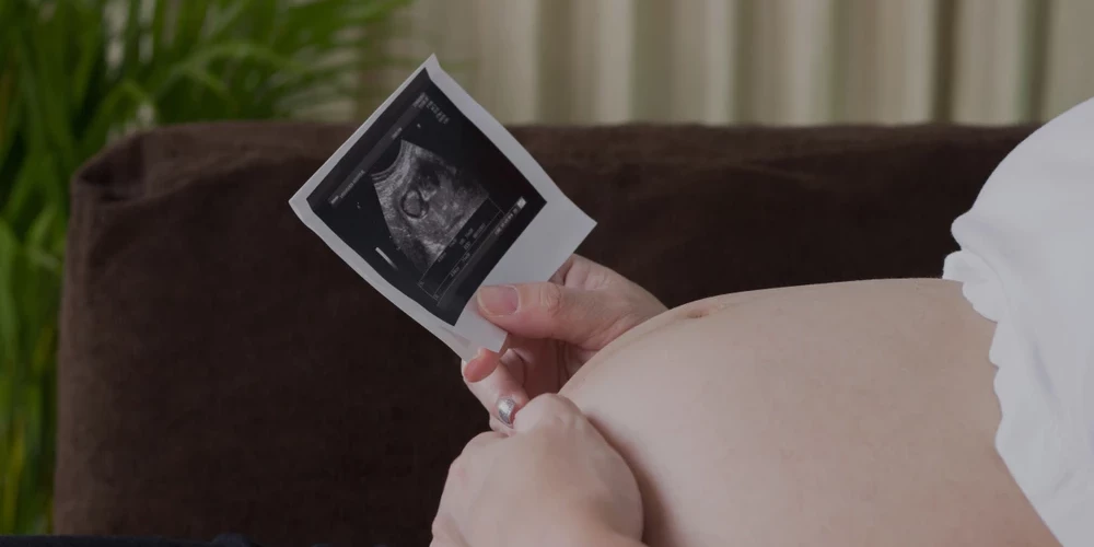 Gadās, ka augļūdeņos nokļūst mekonijs – lipīga, tumši zaļa masa, kas būs jaundzimuša bērna pirmā vēdera izeja.