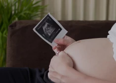 Kā bērniņš nokārtojas mammas vēderā?