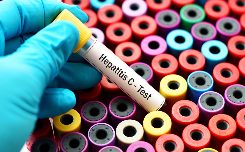 Bīstami nenovērtētais C hepatīts