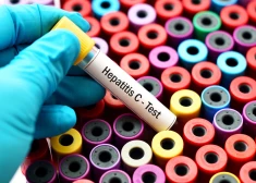 Bīstami nenovērtētais C hepatīts 