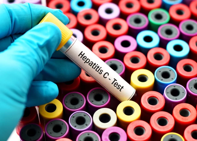 Bīstami nenovērtētais C hepatīts 