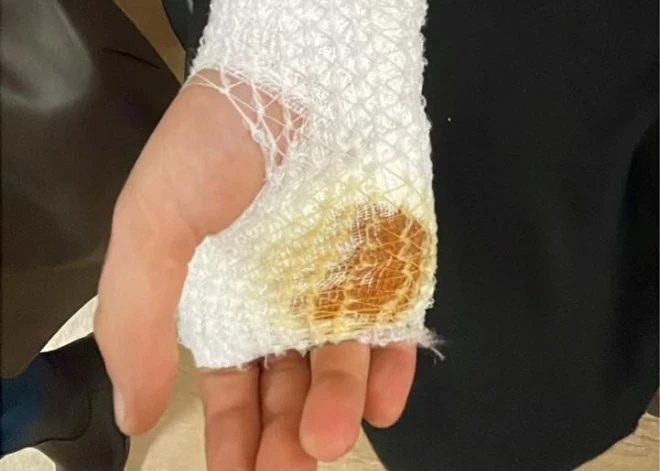 Noskaidrots, ka 9 gadus veco zēnu Imantā sadūra 12 gadus vecs jaunietis