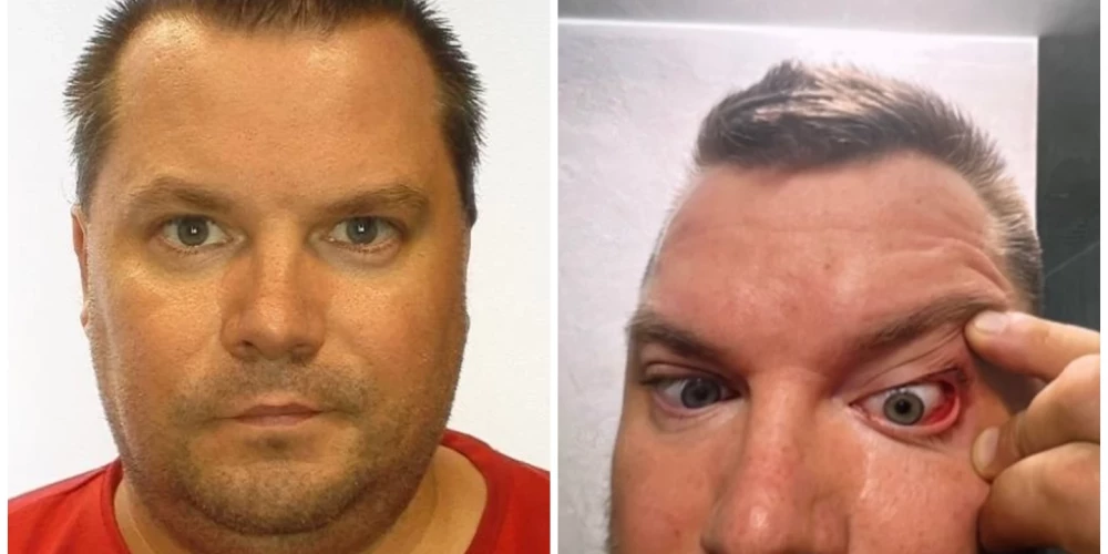 Valsts policijas Rīgas reģiona pārvaldes Kriminālpolicijas pārvaldes amatpersonas aizdomās par vairāku smagu noziegumu izdarīšanu ir aizturējušas attēlā redzamo 1979. gadā dzimušo vīrieti.