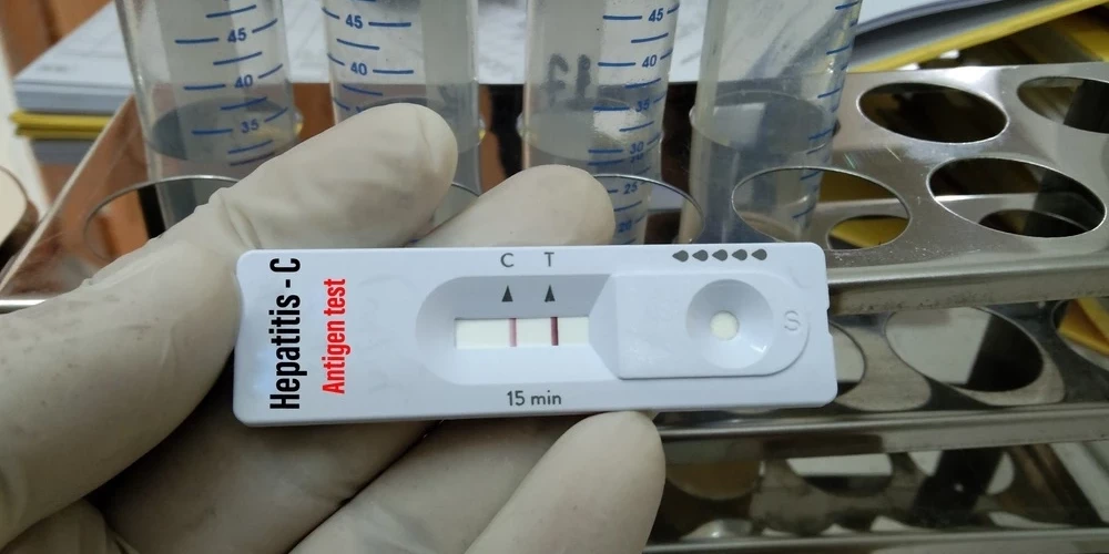 Быстрый тест на гепатит C.