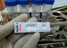 Петeрис Апинис рассказал Otkrito.lv о гепатите С и о том, как его избежать 